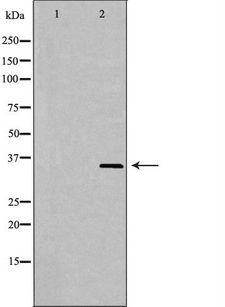 MLST8 / GBL Antibody - Western blot analysis of mouse brain lysate using MLST8 antibody. The lane on the left is treated with the antigen-specific peptide.