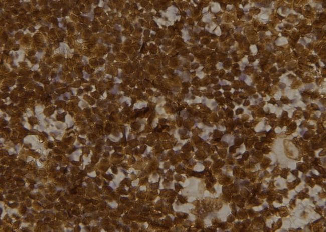 MLST8 / GBL Antibody - 1:100 staining mouse spleen tissue by IHC-P. The sample was formaldehyde fixed and a heat mediated antigen retrieval step in citrate buffer was performed. The sample was then blocked and incubated with the antibody for 1.5 hours at 22°C. An HRP conjugated goat anti-rabbit antibody was used as the secondary.
