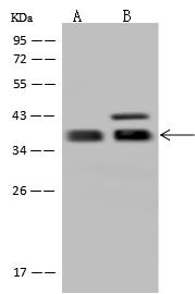 MLST8 / GBL Antibody - Anti-MLST8 rabbit polyclonal antibody at 1:500 dilution. Lane A: HeLa Whole Cell Lysate. Lane B: U-251 MG Whole Cell Lysate. Lysates/proteins at 30 ug per lane. Secondary: Goat Anti-Rabbit IgG (H+L)/HRP at 1/10000 dilution. Developed using the ECL technique. Performed under reducing conditions. Predicted band size: 35 kDa. Observed band size: 38 kDa. (We are unsure as to the identity of these extra bands.)
