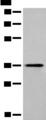 MLST8 / GBL Antibody - Western blot analysis of Human liver tissue lysate  using MLST8 Polyclonal Antibody at dilution of 1:400