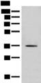 MLST8 / GBL Antibody - Western blot analysis of Hela cell lysate  using MLST8 Polyclonal Antibody at dilution of 1:500