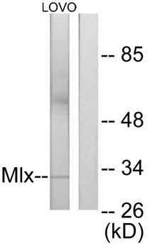 MLX / TCFL4 Antibody - Western blot analysis of lysates from LOVO cells, using Mlx Antibody. The lane on the right is blocked with the synthesized peptide.