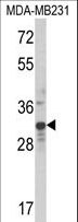 MLX / TCFL4 Antibody - Western blot of MLX Antibody in MDA-MB231 cell line lysates (35 ug/lane). MLX (arrow) was detected using the purified antibody.