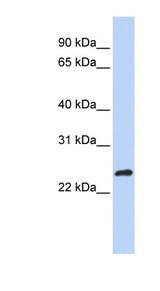 MLX / TCFL4 Antibody - MLX antibody Western blot of MCF7 cell lysate. This image was taken for the unconjugated form of this product. Other forms have not been tested.