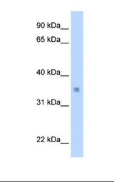 MLX / TCFL4 Antibody - Transfected 293T cell lysate. Antibody concentration: 0.5 ug/ml. Gel concentration: 12%.  This image was taken for the unconjugated form of this product. Other forms have not been tested.