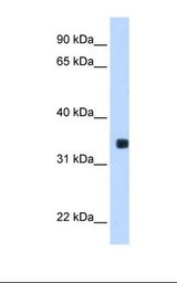 MLX / TCFL4 Antibody - Transfected 293T cell lysate. Antibody concentration: 0.25 ug/ml. Gel concentration: 12%.  This image was taken for the unconjugated form of this product. Other forms have not been tested.