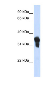 MLX / TCFL4 Antibody - MLX antibody Western blot of Transfected 293T cell lysate. This image was taken for the unconjugated form of this product. Other forms have not been tested.