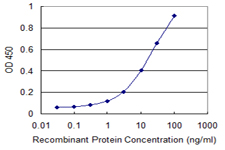 MLX / TCFL4 Antibody - Detection limit for recombinant GST tagged MLX is 0.3 ng/ml as a capture antibody.