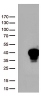 MLX / TCFL4 Antibody - HEK293T cells were transfected with the pCMV6-ENTRY control. (Left lane) or pCMV6-ENTRY MLX. (Right lane) cDNA for 48 hrs and lysed. Equivalent amounts of cell lysates. (5 ug per lane) were separated by SDS-PAGE and immunoblotted with anti-MLX. (1:500)
