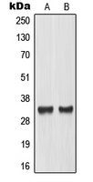 MLX / TCFL4 Antibody - Western blot analysis of TCFL4 expression in LOVO (A); mouse placenta (B) whole cell lysates.