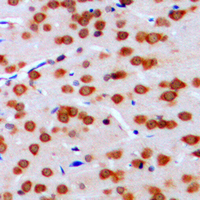 MLX / TCFL4 Antibody - Immunohistochemical analysis of TCFL4 staining in human brain formalin fixed paraffin embedded tissue section. The section was pre-treated using heat mediated antigen retrieval with sodium citrate buffer (pH 6.0). The section was then incubated with the antibody at room temperature and detected using an HRP conjugated compact polymer system. DAB was used as the chromogen. The section was then counterstained with hematoxylin and mounted with DPX.