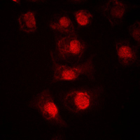 MLX / TCFL4 Antibody - Immunofluorescent analysis of TCFL4 staining in LOVO cells. Formalin-fixed cells were permeabilized with 0.1% Triton X-100 in TBS for 5-10 minutes and blocked with 3% BSA-PBS for 30 minutes at room temperature. Cells were probed with the primary antibody in 3% BSA-PBS and incubated overnight at 4 C in a humidified chamber. Cells were washed with PBST and incubated with a DyLight 594-conjugated secondary antibody (red) in PBS at room temperature in the dark. DAPI was used to stain the cell nuclei (blue).