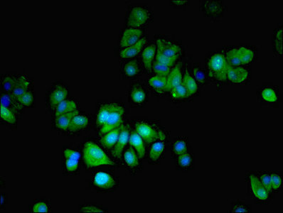 MLX / TCFL4 Antibody - Immunofluorescent analysis of MCF-7 cells using MLX Antibody at dilution of 1:100 and Alexa Fluor 488-congugated AffiniPure Goat Anti-Rabbit IgG(H+L)