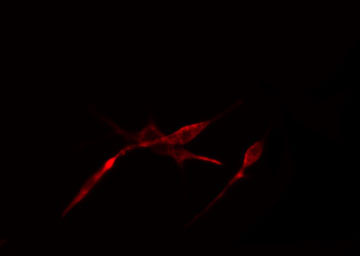 MLX / TCFL4 Antibody - Staining LOVO cells by IF/ICC. The samples were fixed with PFA and permeabilized in 0.1% Triton X-100, then blocked in 10% serum for 45 min at 25°C. The primary antibody was diluted at 1:200 and incubated with the sample for 1 hour at 37°C. An Alexa Fluor 594 conjugated goat anti-rabbit IgG (H+L) antibody, diluted at 1/600, was used as secondary antibody.