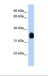 MLX / TCFL4 Antibody - Transfected 293T cell lysate. Antibody concentration: 1.25 ug/ml. Gel concentration: 12%.  This image was taken for the unconjugated form of this product. Other forms have not been tested.