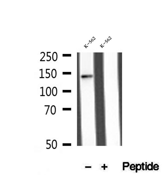 MLXIP / MONDOA Antibody - Western blot analysis of extracts of K562 cells using MLXIP antibody.