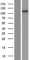 MLXIP / MONDOA Protein - Western validation with an anti-DDK antibody * L: Control HEK293 lysate R: Over-expression lysate