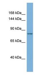 MLXIPL / CHREBP Antibody - MLXIPL / CHREBP antibody Western Blot of Mouse Thymus. Antibody dilution: 1 ug/ml.  This image was taken for the unconjugated form of this product. Other forms have not been tested.