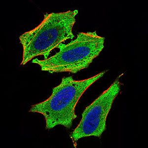MLXIPL / CHREBP Antibody - Immunofluorescence of HeLa cells using MLXIPL mouse monoclonal antibody (green). Blue: DRAQ5 fluorescent DNA dye. Red: Actin filaments have been labeled with Alexa Fluor-555 phalloidin.
