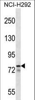 MLXIPL / CHREBP Antibody - MLXIPL Antibody western blot of NCI-H292 cell line lysates (35 ug/lane). The MLXIPL antibody detected the MLXIPL protein (arrow).