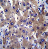 MLXIPL / CHREBP Antibody - MLXIPL Antibody immunohistochemistry of formalin-fixed and paraffin-embedded human liver tissue followed by peroxidase-conjugated secondary antibody and DAB staining.