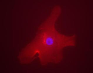 MLXIPL / CHREBP Antibody - Immunofluorescent staining of a human hepatocyte. Overlay staining of ChREBP (Rhodamine red) and DAPI nuclear staining (blue).  This image was taken for the unconjugated form of this product. Other forms have not been tested.
