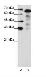 MLXIPL / CHREBP Antibody - A: Marker, B: Jurkat Cell Lysate.  This image was taken for the unconjugated form of this product. Other forms have not been tested.