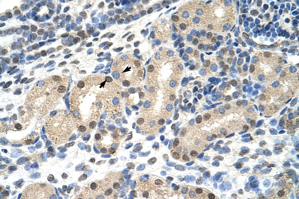 MLXIPL / CHREBP Antibody - MLXIPL / CHREBP antibody ARP39736_T100-AAK20939-MLXIPL (MLX interacting protein-like) Antibody IHC of formalin-fixed, paraffin-embedded human Kidney. Positive label: Epithelial cells of renal tubule indicated with arrows. Antibody concentration 4-8 ug/ml. Magnification 400X.  This image was taken for the unconjugated form of this product. Other forms have not been tested.