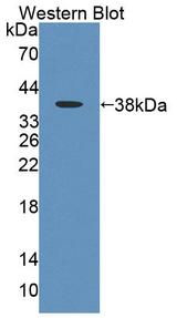 MLYCD / MCD Antibody - Western blot of MLYCD / MCD antibody.