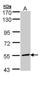 MLYCD / MCD Antibody - Sample (30 ug of whole cell lysate). A: Hep G2 . 7.5% SDS PAGE. MLYCD / MCD antibody diluted at 1:1000