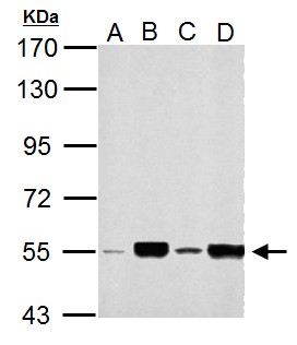 MLYCD / MCD Antibody - Sample (30 ug of whole cell lysate). A: NIH-3T3, B: JC, C: BCL-1, D: C2C12. 7.5% SDS PAGE. MLYCD / MCD antibody diluted at 1:1000.