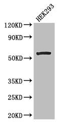 MLYCD / MCD Antibody - Positive WB detected in:HEK293 whole cell lysate;All lanes: MLYCD antibody at 2.7ug/ml;Secondary;Goat polyclonal to rabbit IgG at 1/50000 dilution;Predicted band size: 56,51 kDa;Observed band size: 56 kDa;