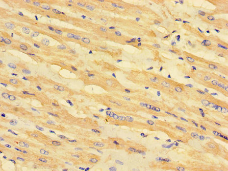 MLYCD / MCD Antibody - Immunohistochemistry of paraffin-embedded human heart tissue using MLYCD Antibody at dilution of 1:100