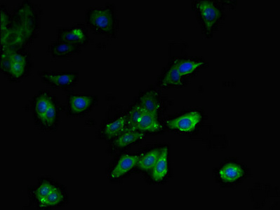MLYCD / MCD Antibody - Immunofluorescent analysis of HepG2 cells using MLYCD Antibody at dilution of 1:100 and Alexa Fluor 488-congugated AffiniPure Goat Anti-Rabbit IgG(H+L)