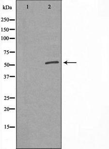 MLZE Antibody - Western blot analysis of extracts of 293 cells using GSDMC antibody. The lane on the left is treated with the antigen-specific peptide.