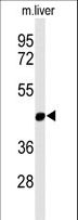 MMAA Antibody - Western blot of MMAA Antibody in mouse liver tissue lysates (35 ug/lane). MMAA (arrow) was detected using the purified antibody.