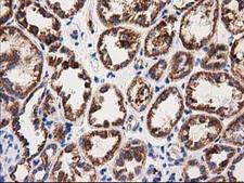 MMAA Antibody - IHC of paraffin-embedded Human Kidney tissue using anti-MMAA mouse monoclonal antibody.