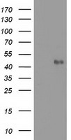 MMAA Antibody - HEK293T cells were transfected with the pCMV6-ENTRY control (Left lane) or pCMV6-ENTRY MMAA (Right lane) cDNA for 48 hrs and lysed. Equivalent amounts of cell lysates (5 ug per lane) were separated by SDS-PAGE and immunoblotted with anti-MMAA.
