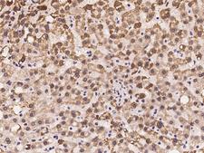 MMAA Antibody - Immunochemical staining of human MMAA in human liver with rabbit polyclonal antibody at 1:100 dilution, formalin-fixed paraffin embedded sections.