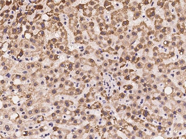 MMAA Antibody - Immunochemical staining of human MMAA in human liver with rabbit polyclonal antibody at 1:100 dilution, formalin-fixed paraffin embedded sections.