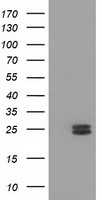 MMAB Antibody - HEK293T cells were transfected with the pCMV6-ENTRY control (Left lane) or pCMV6-ENTRY MMAB (Right lane) cDNA for 48 hrs and lysed. Equivalent amounts of cell lysates (5 ug per lane) were separated by SDS-PAGE and immunoblotted with anti-MMAB.
