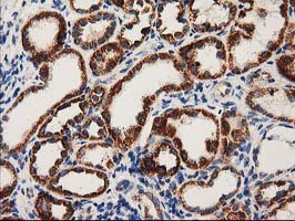 MMAB Antibody - IHC of paraffin-embedded Human Kidney tissue using anti-MMAB mouse monoclonal antibody. (Heat-induced epitope retrieval by 10mM citric buffer, pH6.0, 100C for 10min).