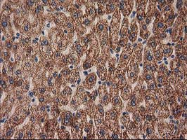 MMAB Antibody - IHC of paraffin-embedded Human liver tissue using anti-MMAB mouse monoclonal antibody. (Heat-induced epitope retrieval by 10mM citric buffer, pH6.0, 100C for 10min).