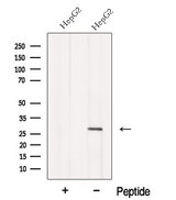 MMAB Antibody - Western blot analysis of extracts of HepG2 cells using MMAB antibody. The lane on the left was treated with blocking peptide.