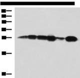 MMAB Antibody - Western blot analysis of 293T cell Human bladder transitional cell carcinoma grade 2-3 tissue lysate MCF-7 cell lysates  using MMAB Polyclonal Antibody at dilution of 1:1400