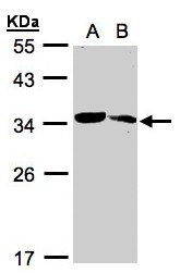 MMACHC Antibody - Sample (30 ug whole cell lysate). A:293T, B: Raji . 12% SDS PAGE. MMACHC antibody diluted at 1:1000