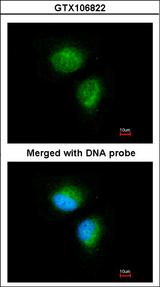 MMACHC Antibody - Immunofluorescence of paraformaldehyde-fixed HeLa using MMACHC antibody at 1:100 dilution.
