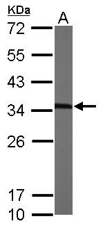MMACHC Antibody - Sample (50 ug of whole cell lysate). A: Mouse brain. 12% SDS PAGE. MMACHC antibody diluted at 1:1000.