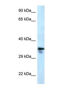 MMACHC Antibody - MMACHC antibody Western blot of U937 Cell lysate. Antibody concentration 1 ug/ml.  This image was taken for the unconjugated form of this product. Other forms have not been tested.