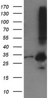 MMACHC Antibody - HEK293T cells were transfected with the pCMV6-ENTRY control (Left lane) or pCMV6-ENTRY MMACHC (Right lane) cDNA for 48 hrs and lysed. Equivalent amounts of cell lysates (5 ug per lane) were separated by SDS-PAGE and immunoblotted with anti-MMACHC.